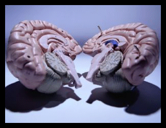 split brain syndrome